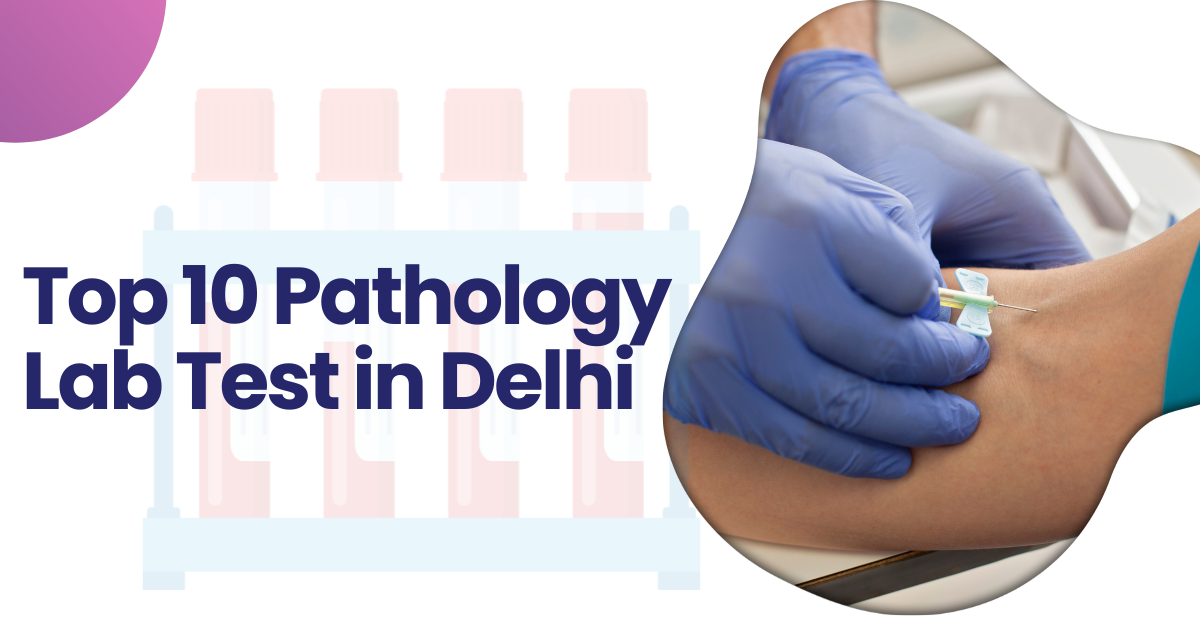 Top 10 Pathology Lab Test in Delhi