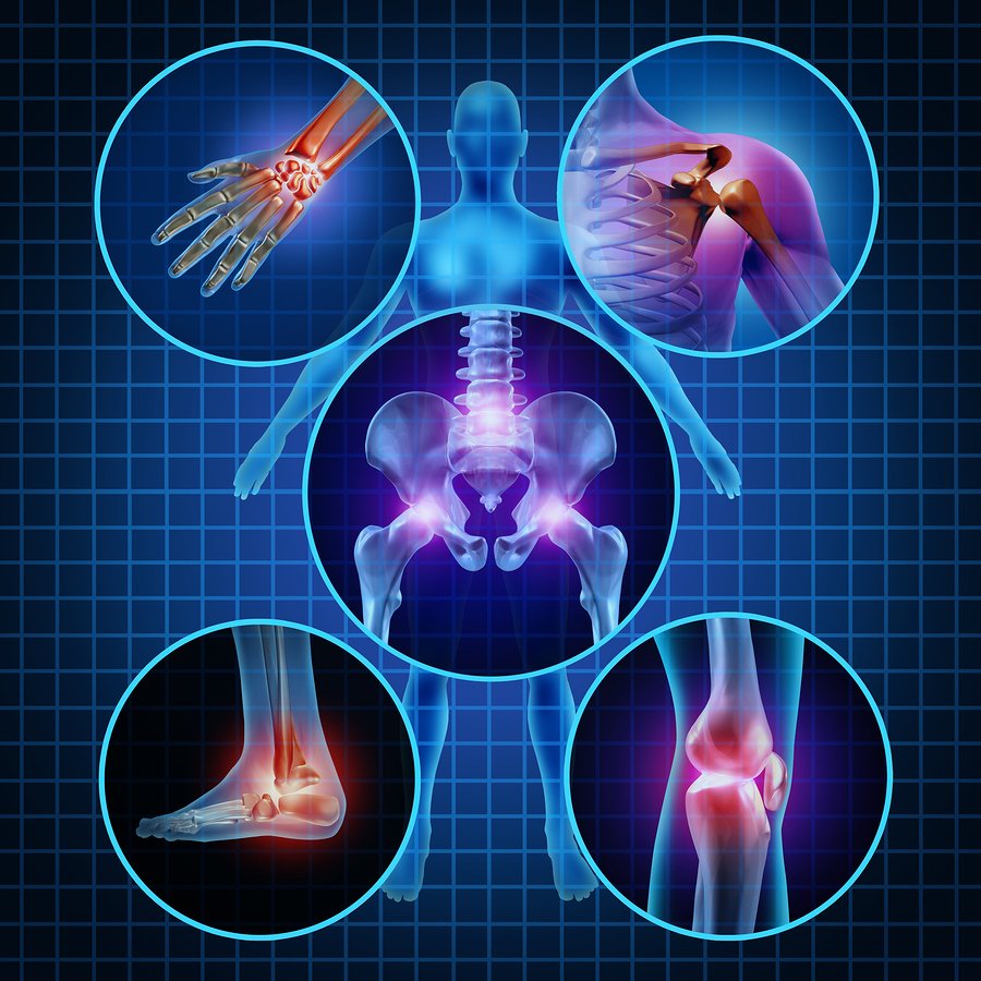 A human skeleton that defined different parts of pain relief